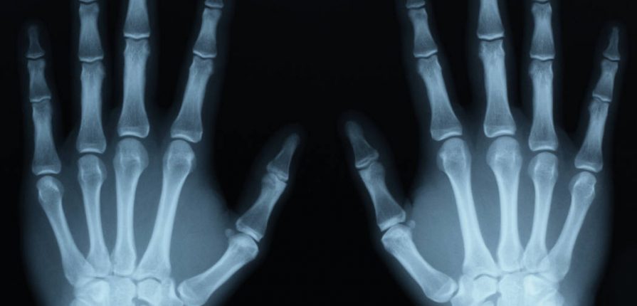 X-Ray the Truth about Insurance